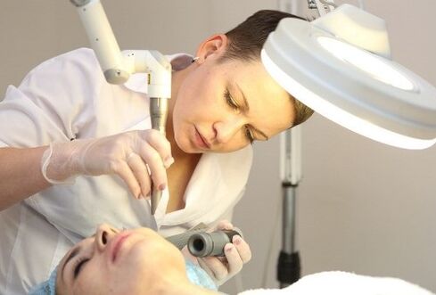 Rimozione del papillomavirus umano con il laser