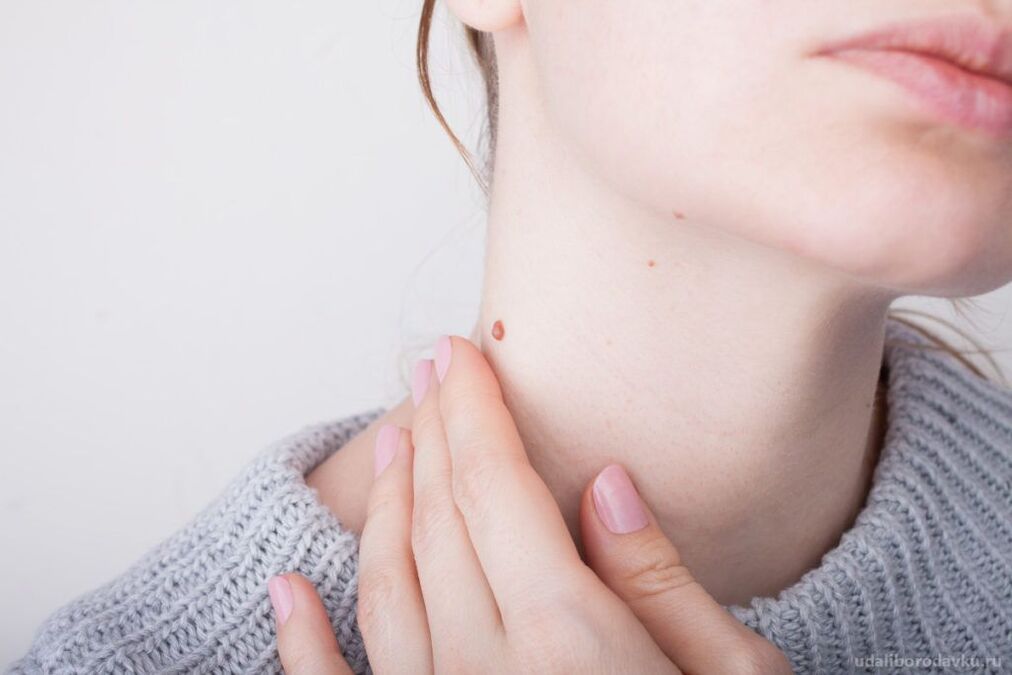 Patogenesi dell'HPV