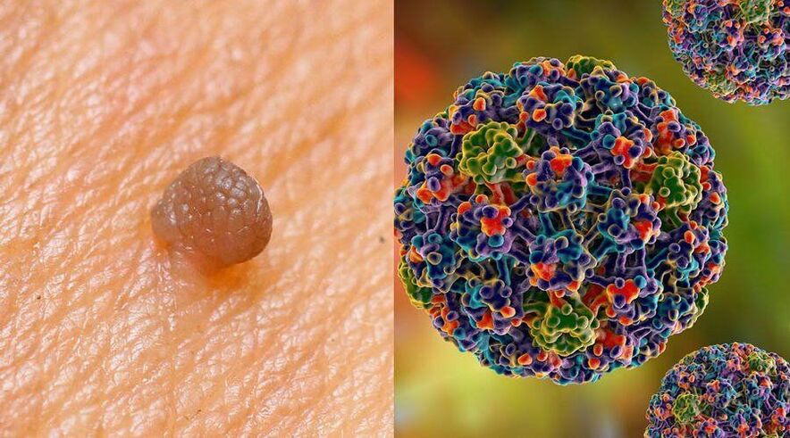 Vie di trasmissione dell'HPV