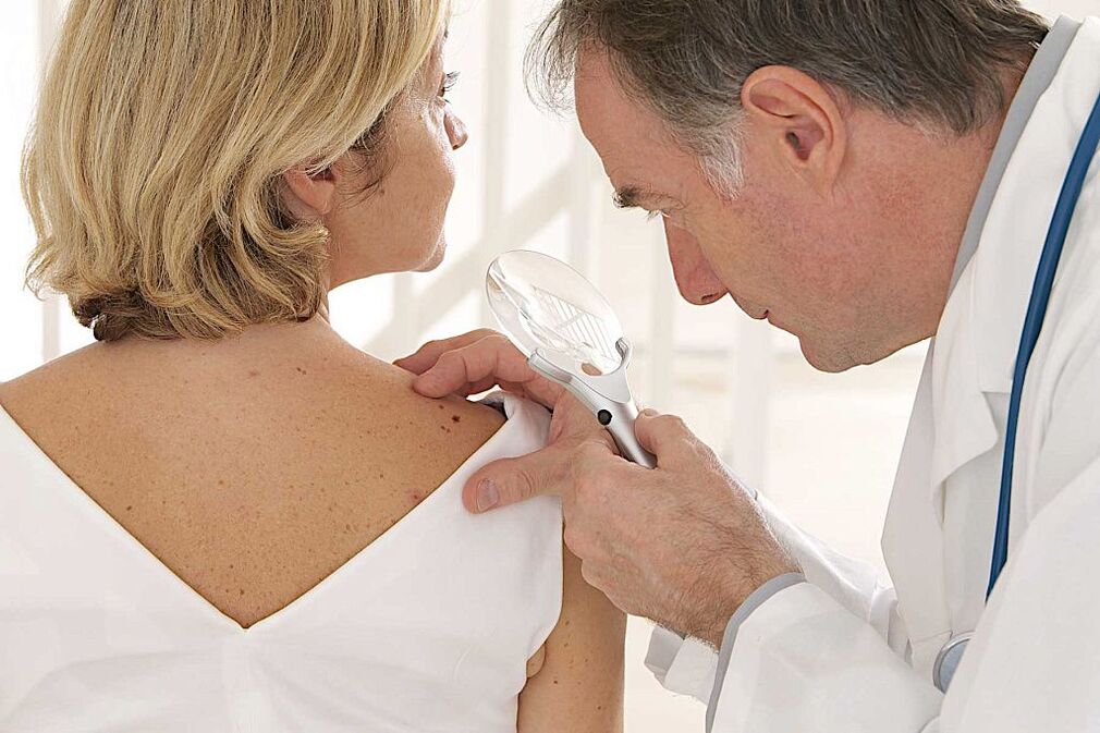 diagnosi del papillomavirus umano